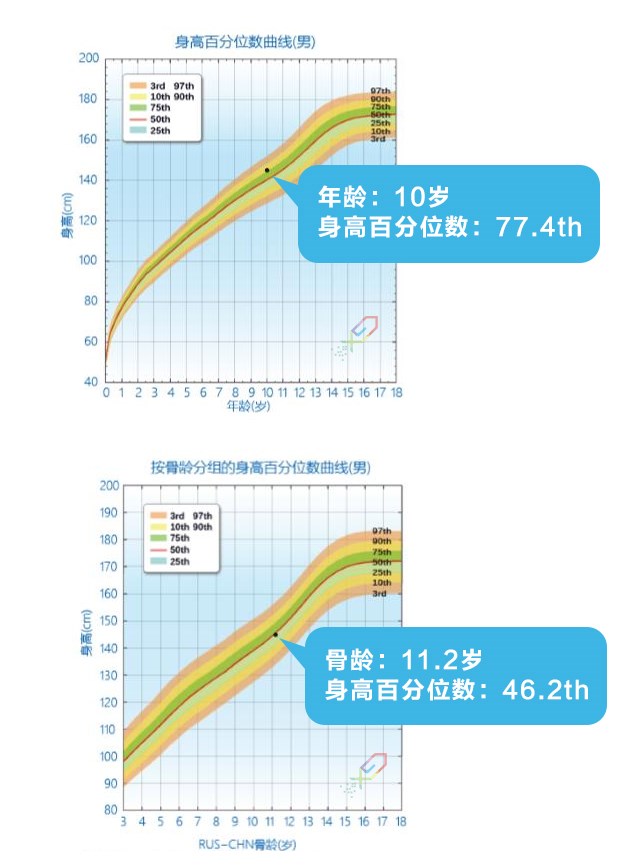 如何正確理解，科學評價孩子的身高？_06.jpg