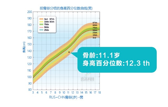 判斷孩子的高矮？這3點(diǎn)沒(méi)搞清楚會(huì)后悔！_05.jpg