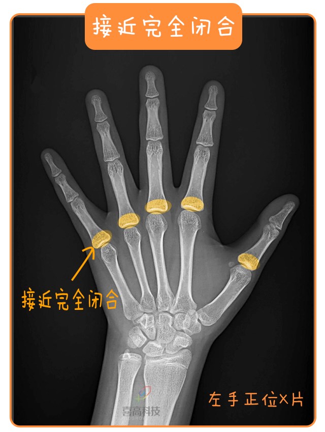 重啟骨骺線~你看起來很誘人！_13.png