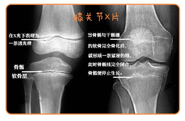 重啟骨骺線~你看起來很誘人！_14.png